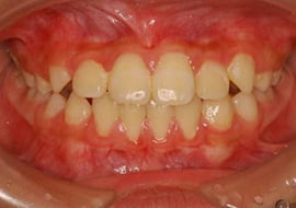 症例紹介 イメージ画像1