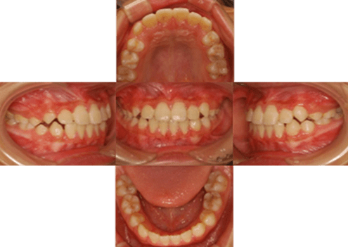 症例紹介 イメージ画像1