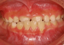 症例紹介 イメージ画像1