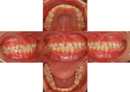 症例紹介 イメージ画像1