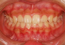 症例紹介 イメージ画像1