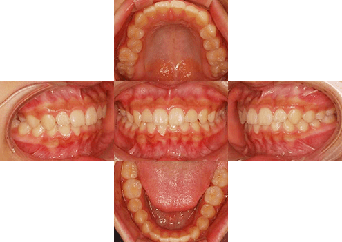 症例紹介 イメージ画像1