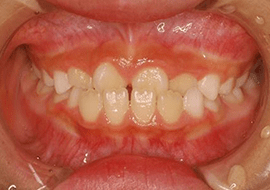 症例紹介 イメージ画像1