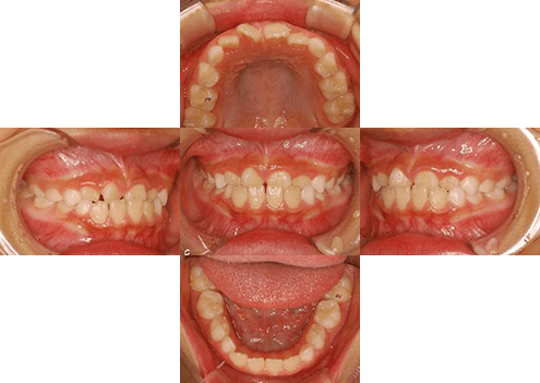 症例紹介 イメージ画像1