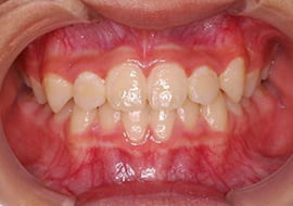 症例紹介 イメージ画像1