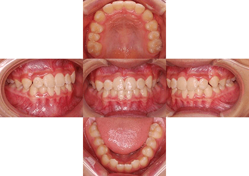 症例紹介 イメージ画像1