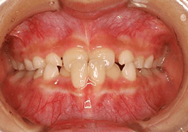 症例紹介 イメージ画像1