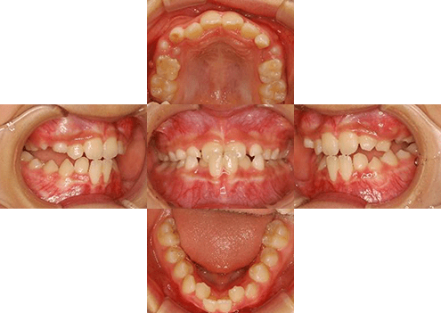 症例紹介 イメージ画像1