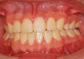 症例紹介 イメージ画像1