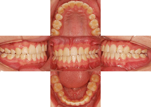 症例紹介 イメージ画像1