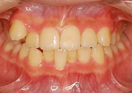 症例紹介 イメージ画像1