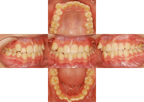 症例紹介 イメージ画像1