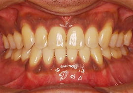 症例紹介 イメージ画像1