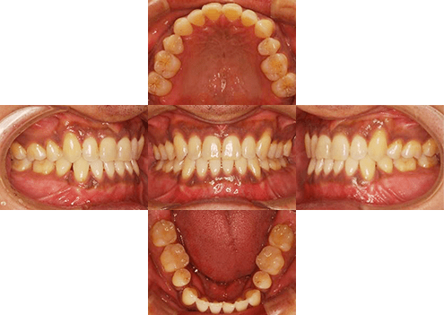 症例紹介 イメージ画像1