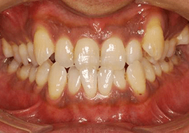 症例紹介 イメージ画像1