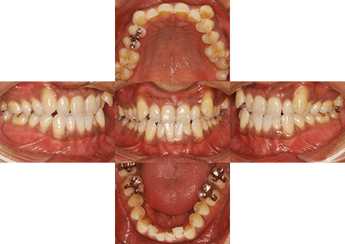 症例紹介 イメージ画像1