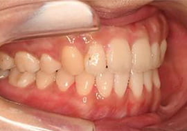 症例紹介 イメージ画像1