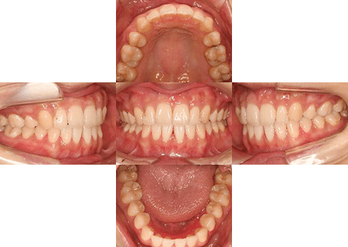 症例紹介 イメージ画像1