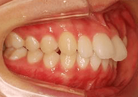 症例紹介 イメージ画像1