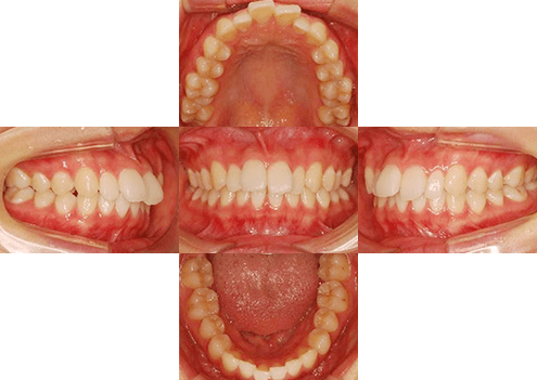 症例紹介 イメージ画像1