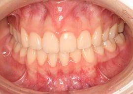 症例紹介 イメージ画像1