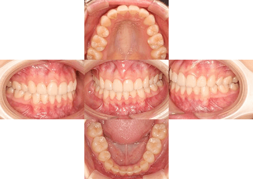 症例紹介 イメージ画像1