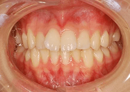 症例紹介 イメージ画像1