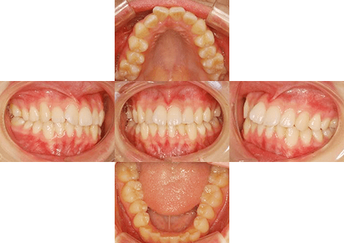 症例紹介 イメージ画像1