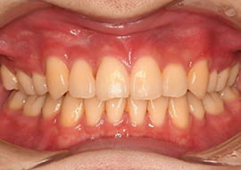 症例紹介 イメージ画像1