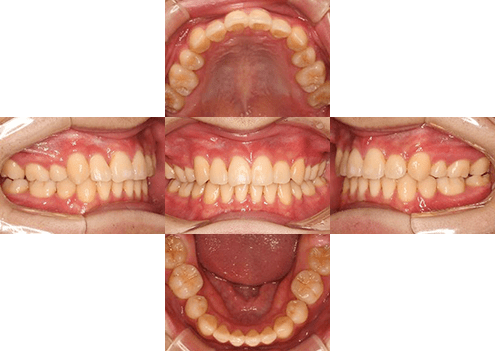 症例紹介 イメージ画像1