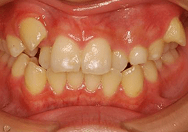 症例紹介 イメージ画像1