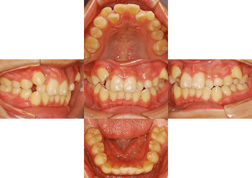 症例紹介 イメージ画像1
